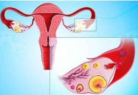 泰国DHC医院可以给高龄及卵巢早衰女性带来孕育希望吗