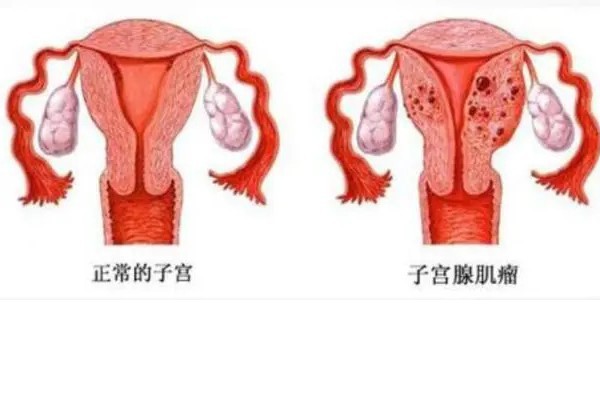 做试管第一次去医院检查要几天，试管第一次去医院检查身体要几天时间