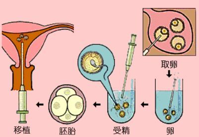 试管囊胚可以做胚胎检测吗？