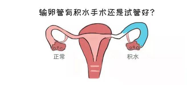 输卵管积水想做试管可行吗？成功率是多少？