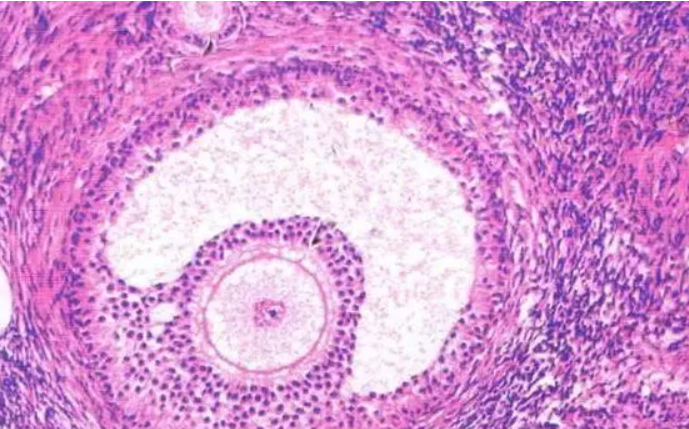 没有卵泡能怀孕吗？试管婴儿可帮你解决