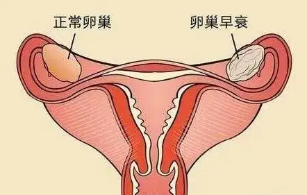 35岁以后amh小于1自然怀孕的几率多高？