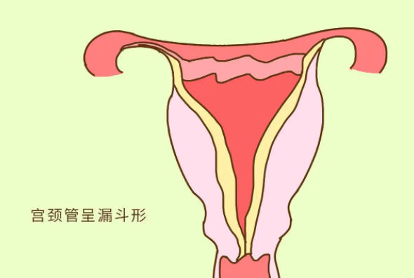 宫颈管长度会发生变化，孕周增加会变得更短