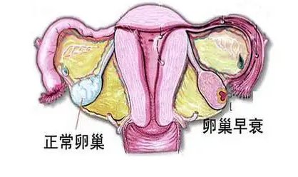 请问卵巢早衰的情况怎么样才能够顺利怀孕？