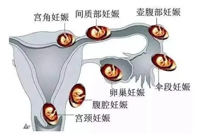 试管婴儿费用