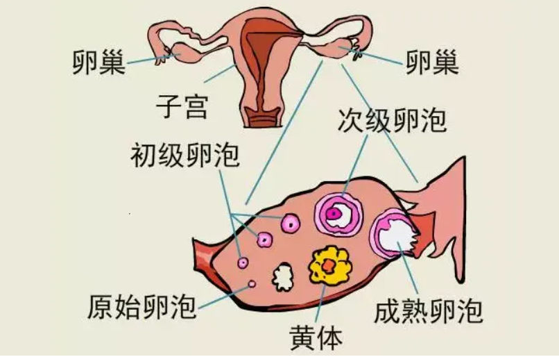 黄体囊肿形成的原因，跟卵泡没拍出并没关系